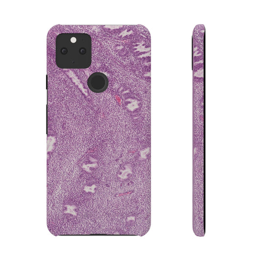 Slim Case Endometrium