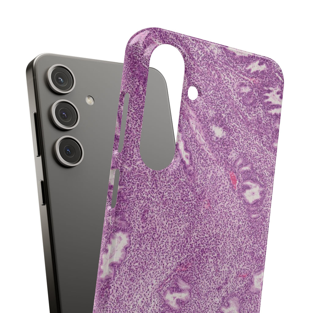 Slim Case Endometrium