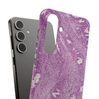 Slim Case Endometrium