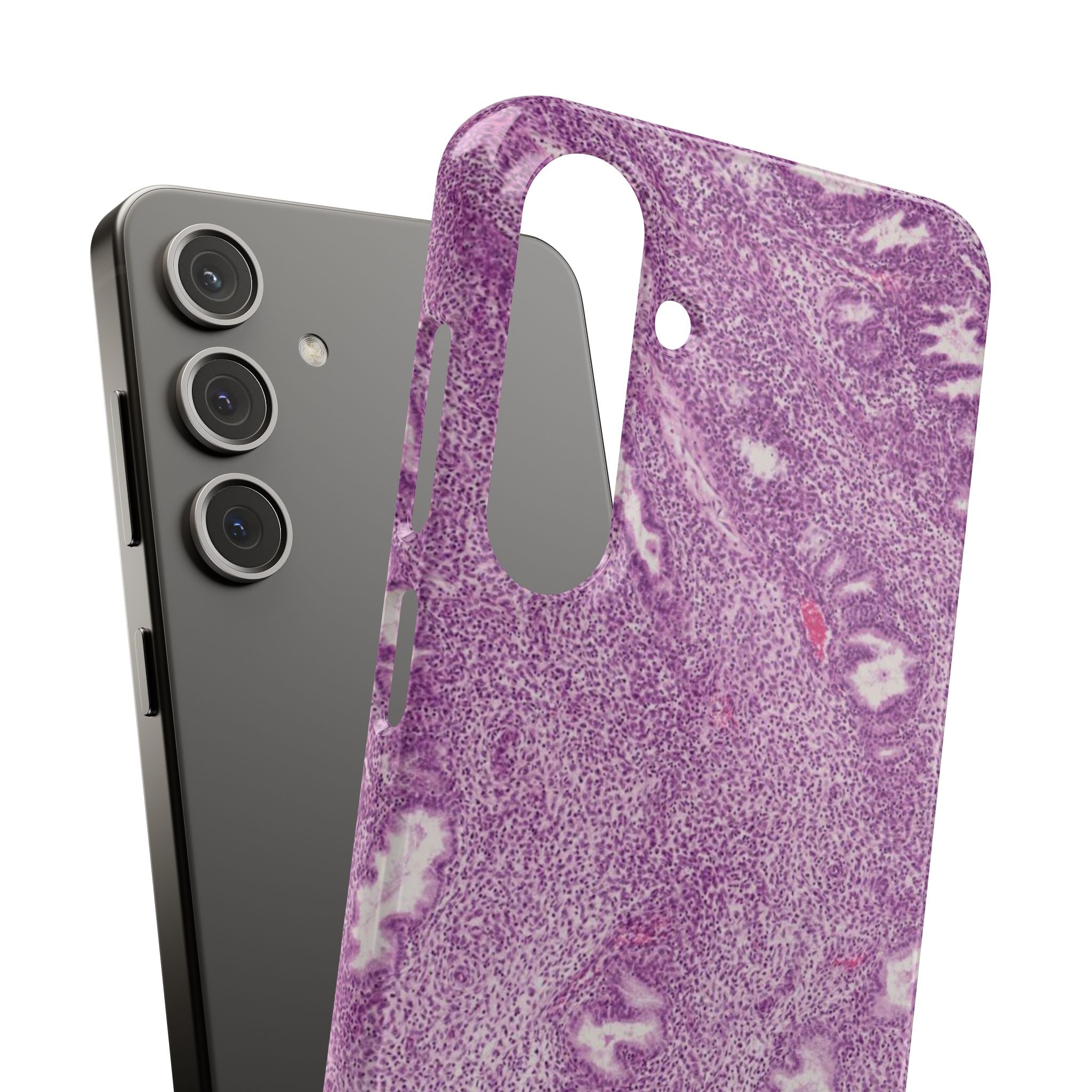 Slim Case Endometrium