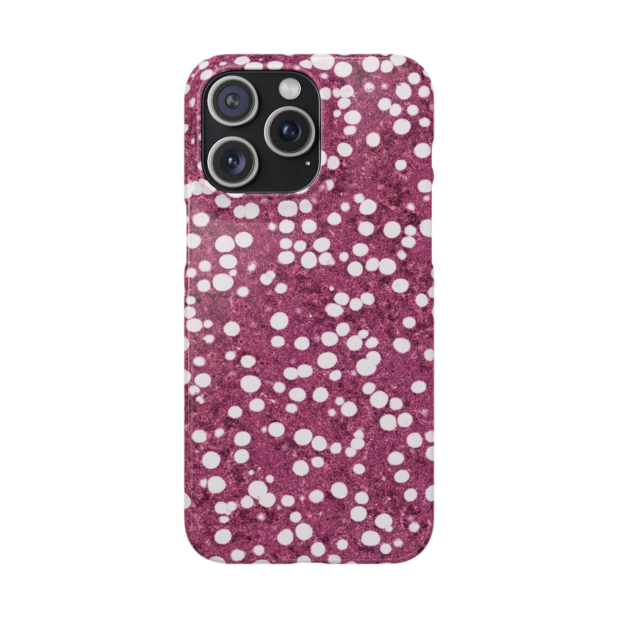 Slim Case Myelolipom