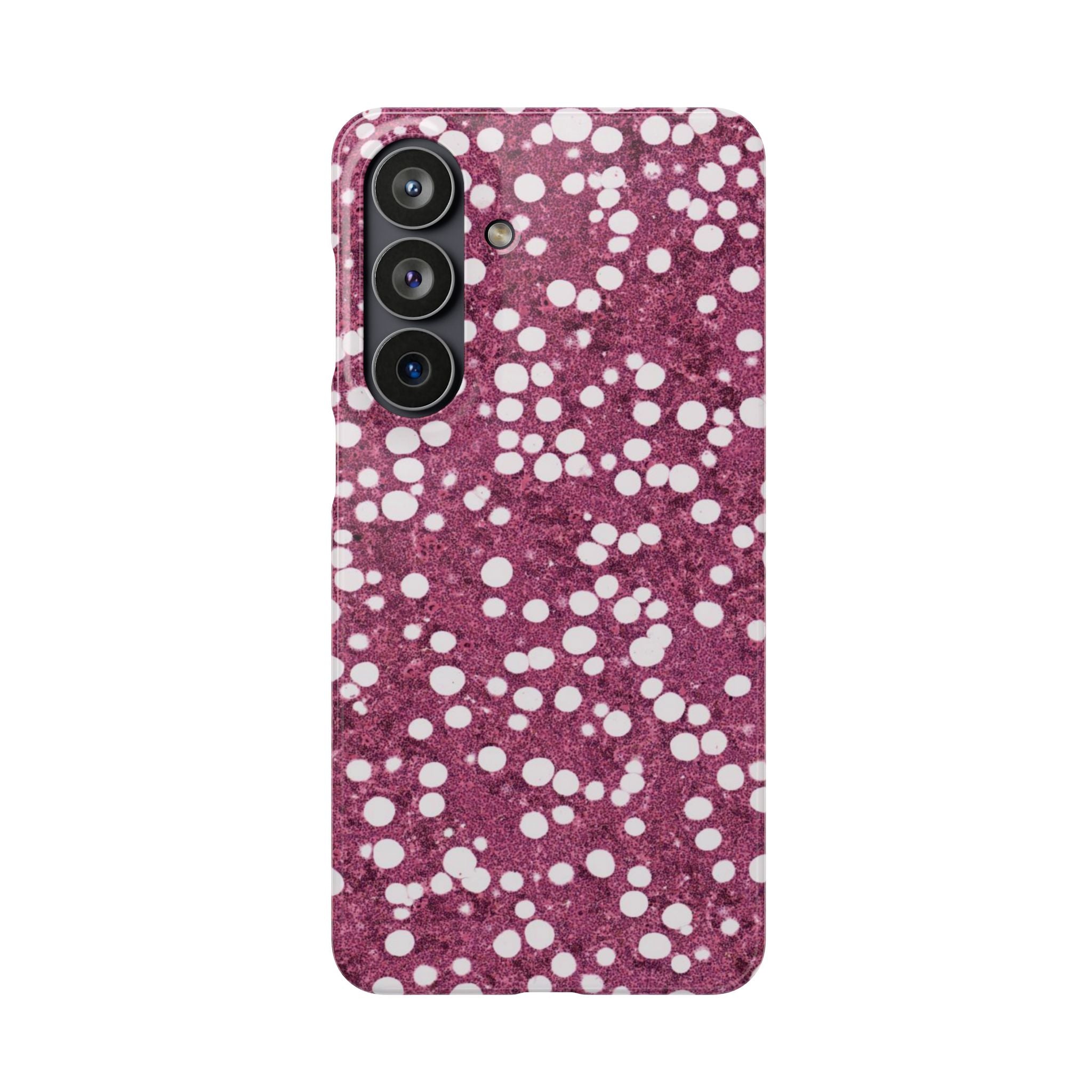 Slim Case Myelolipom