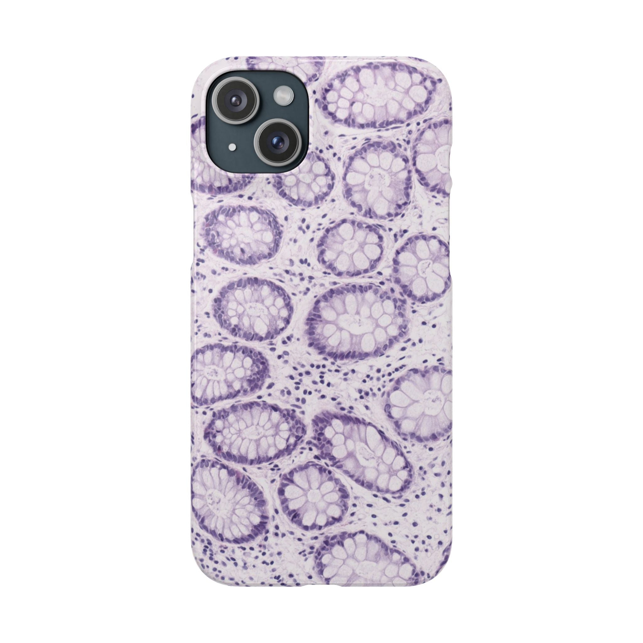 Slim Case Kolon