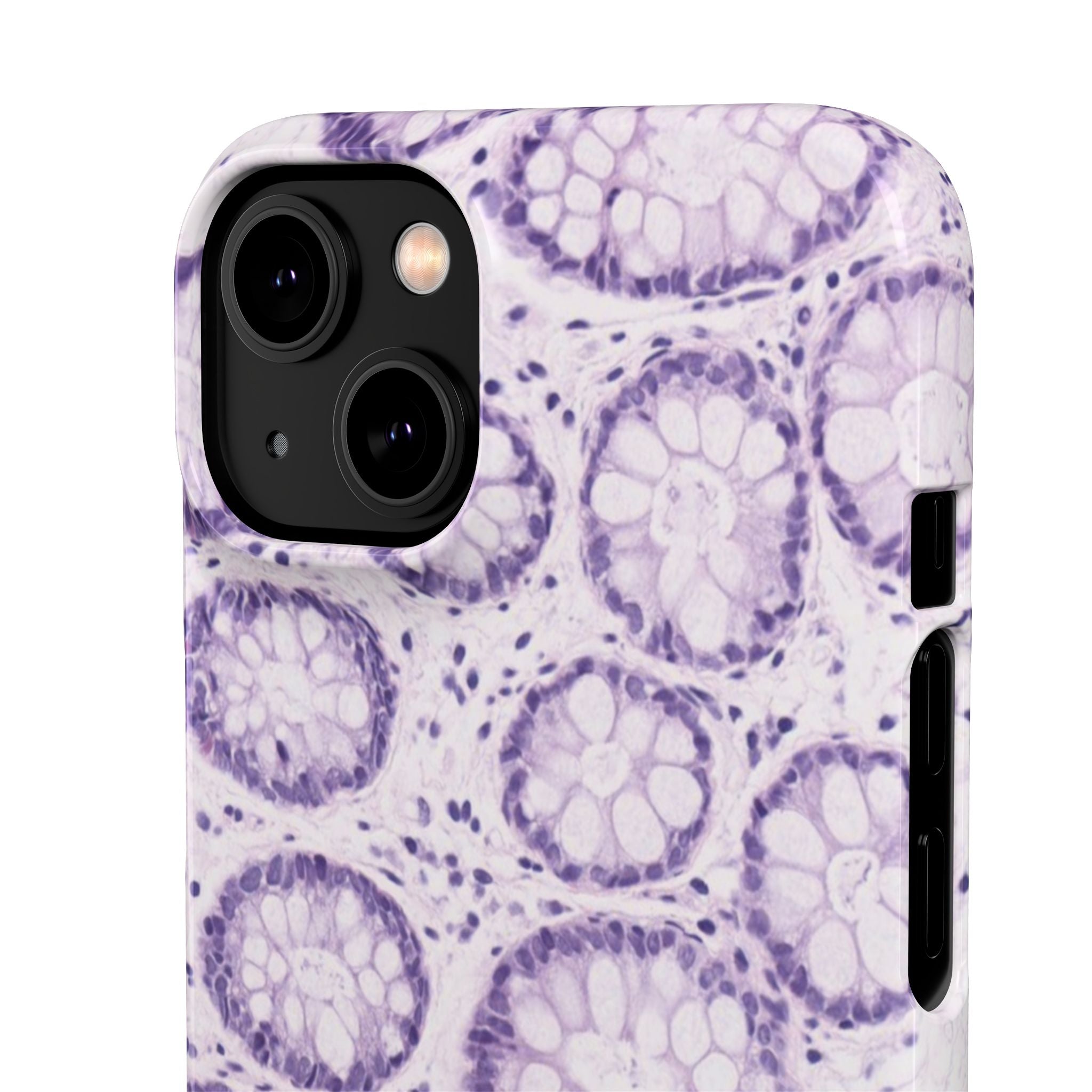 Slim Case Kolon