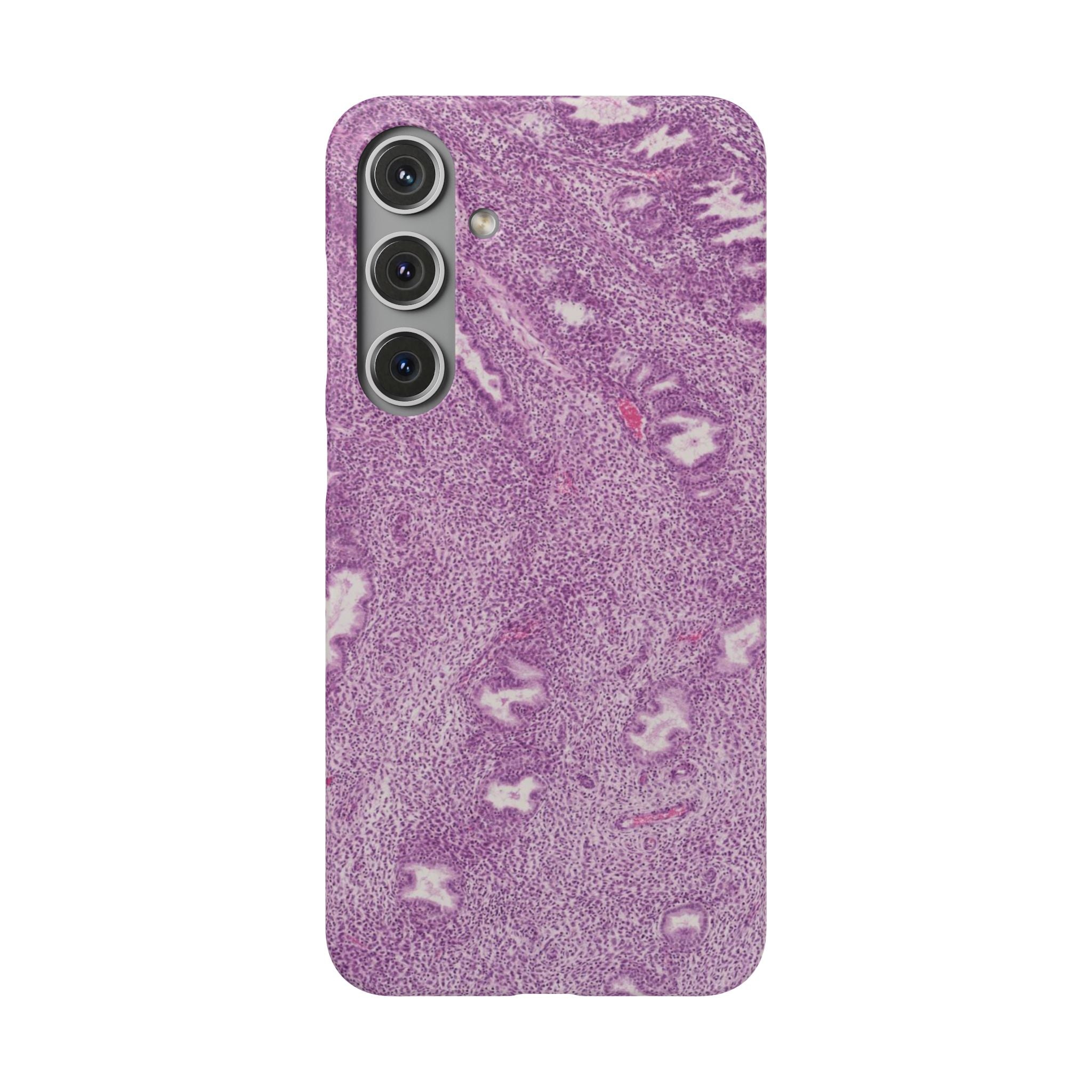 Slim Case Endometrium