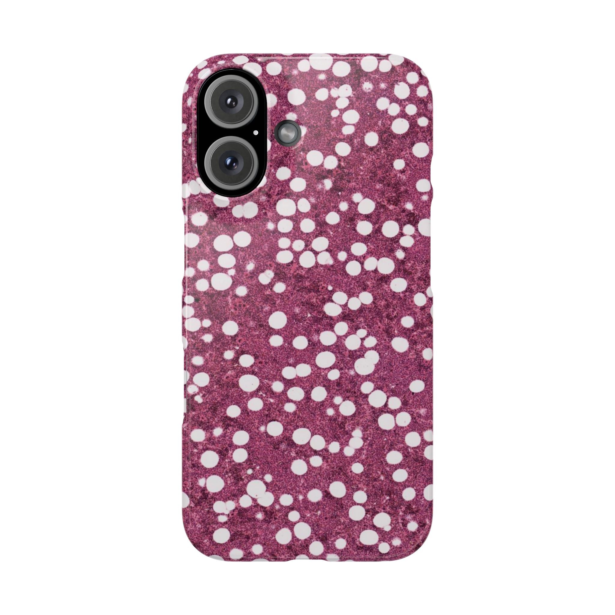 Slim Case Myelolipom