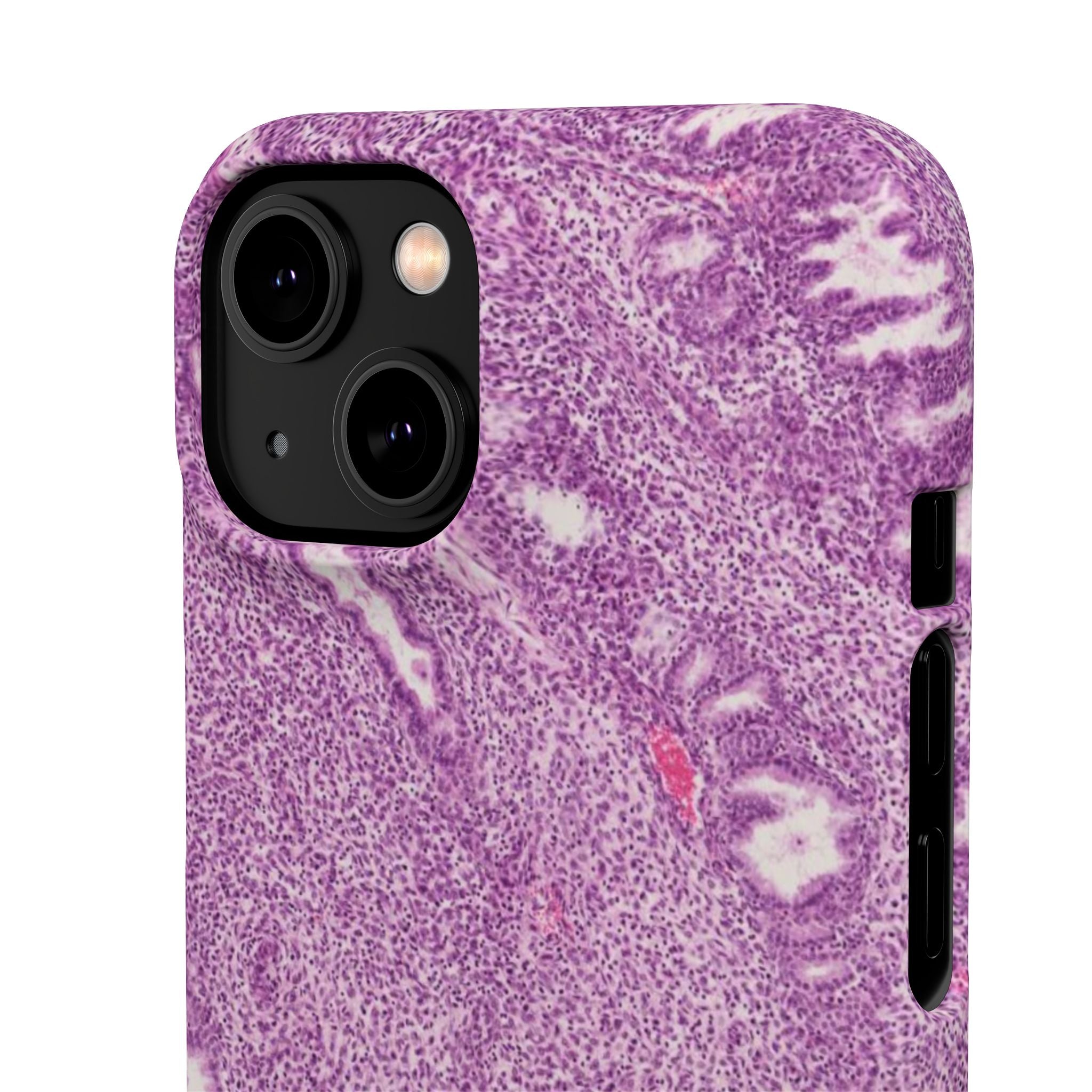 Slim Case Endometrium