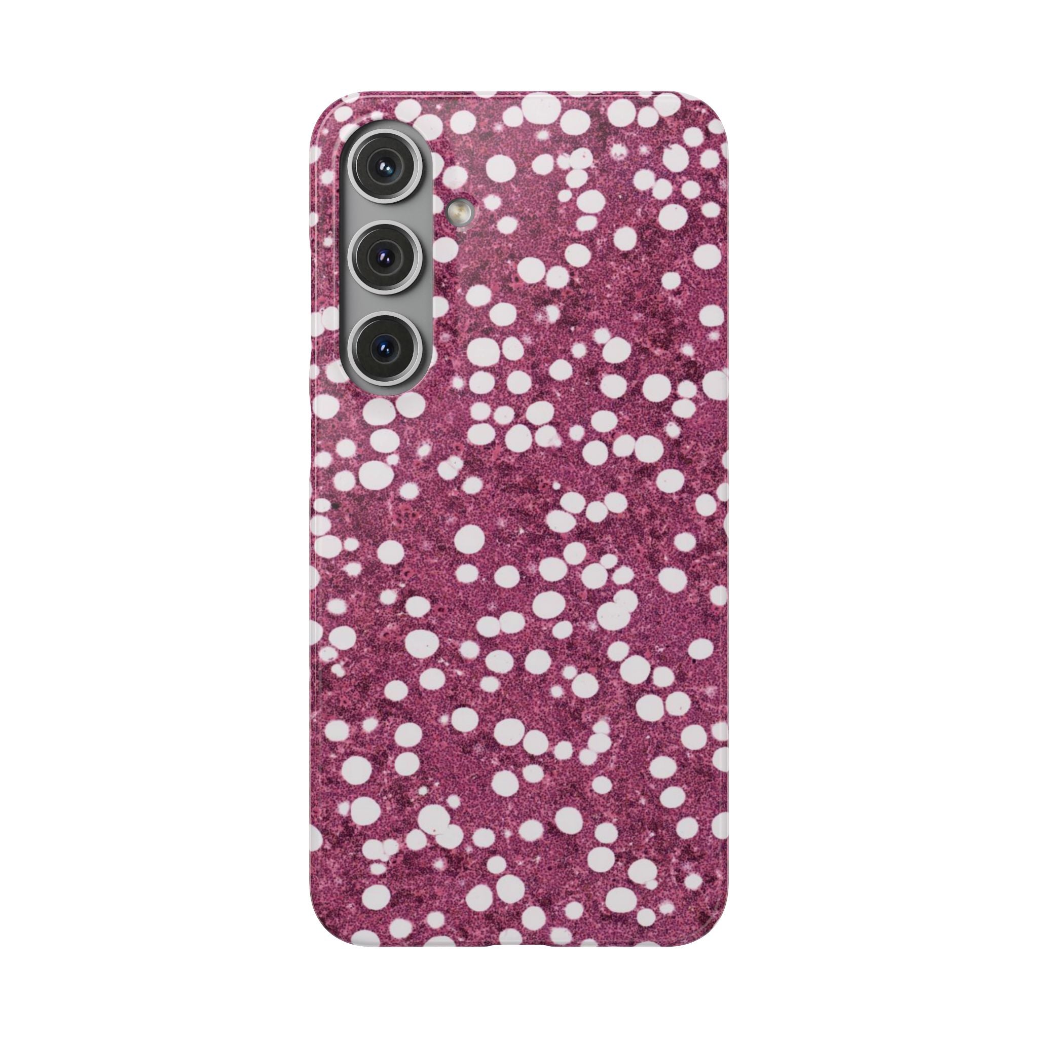 Slim Case Myelolipom