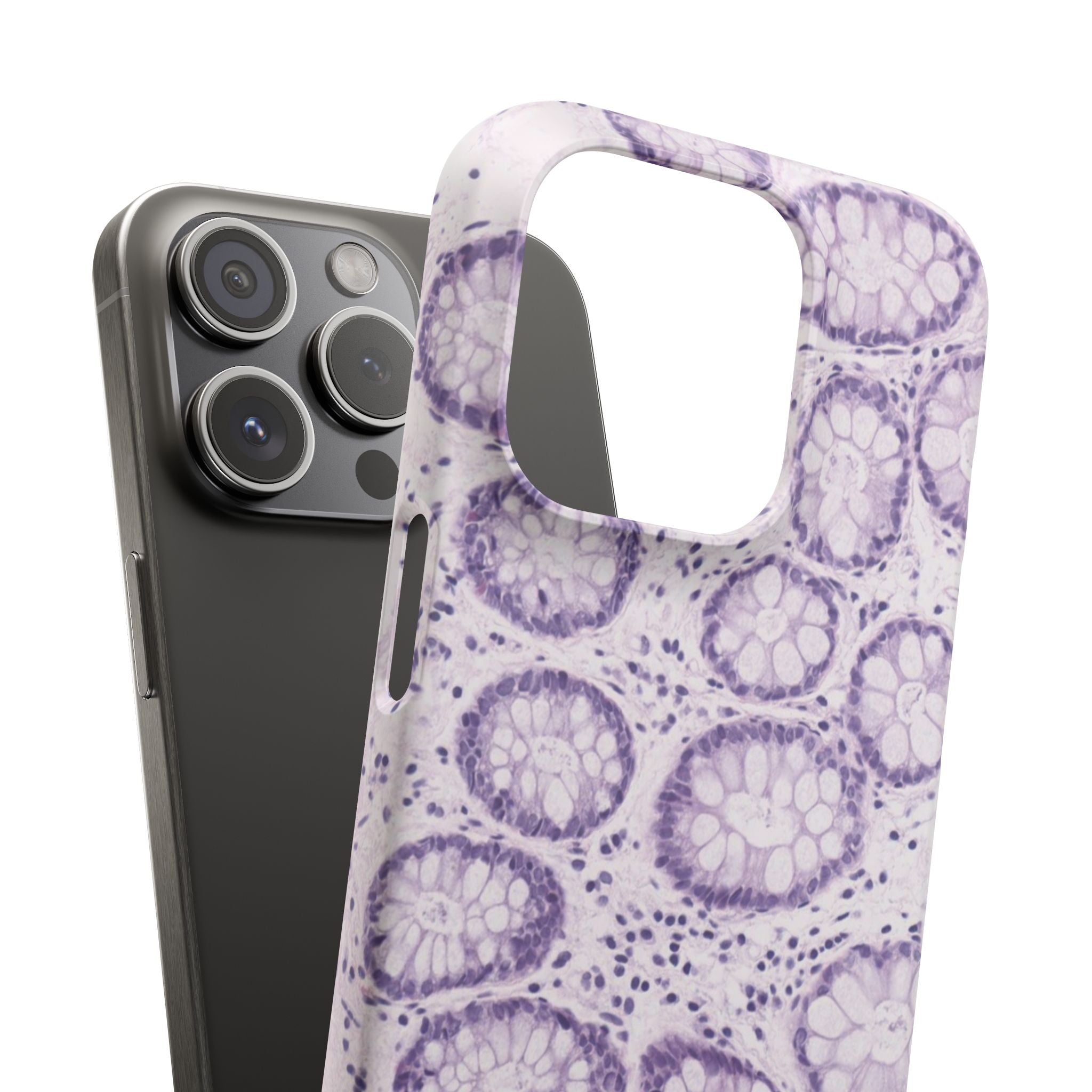 Slim Case Kolon