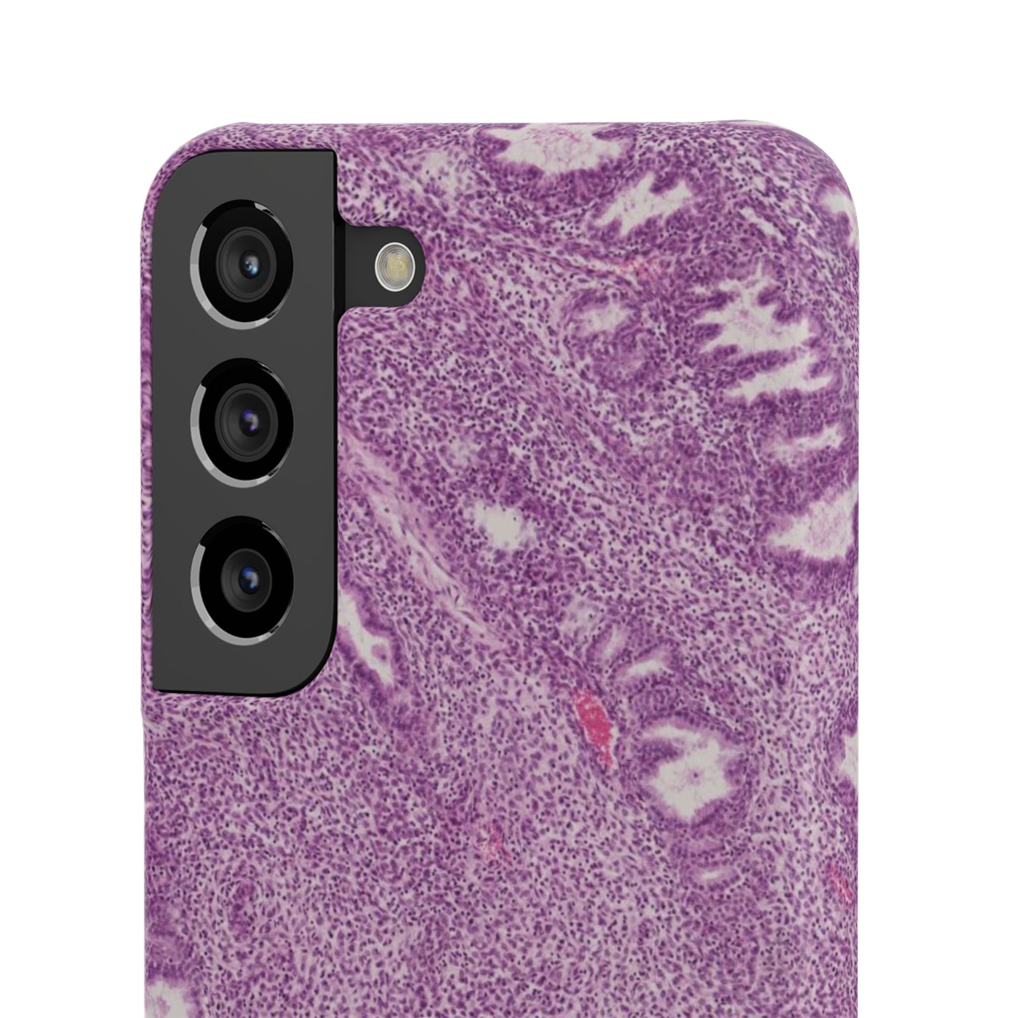 Slim Case Endometrium