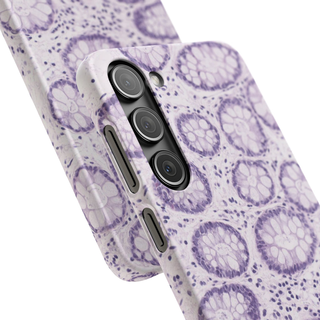 Slim Case Kolon
