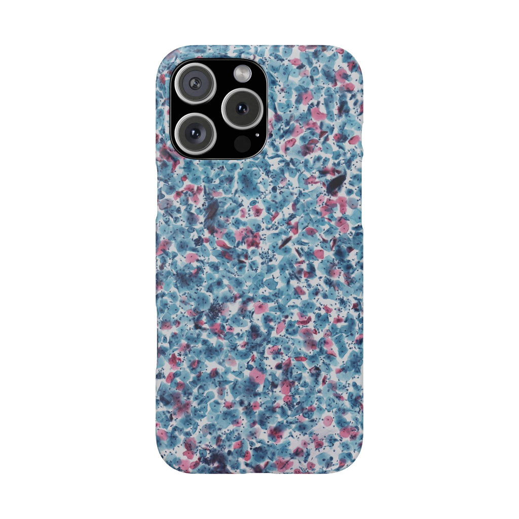Slim Case PAP