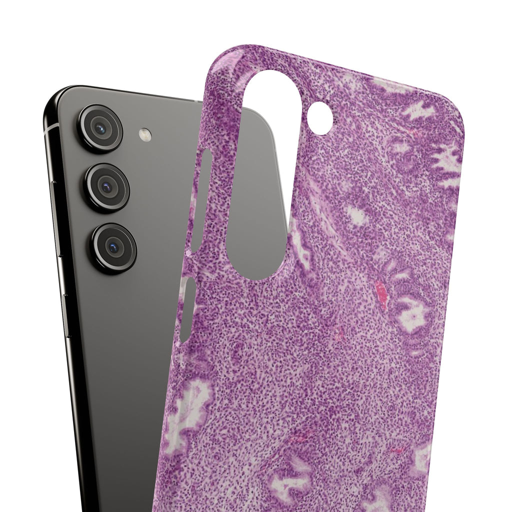 Slim Case Endometrium