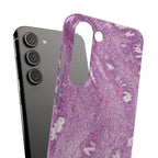 Slim Case Endometrium