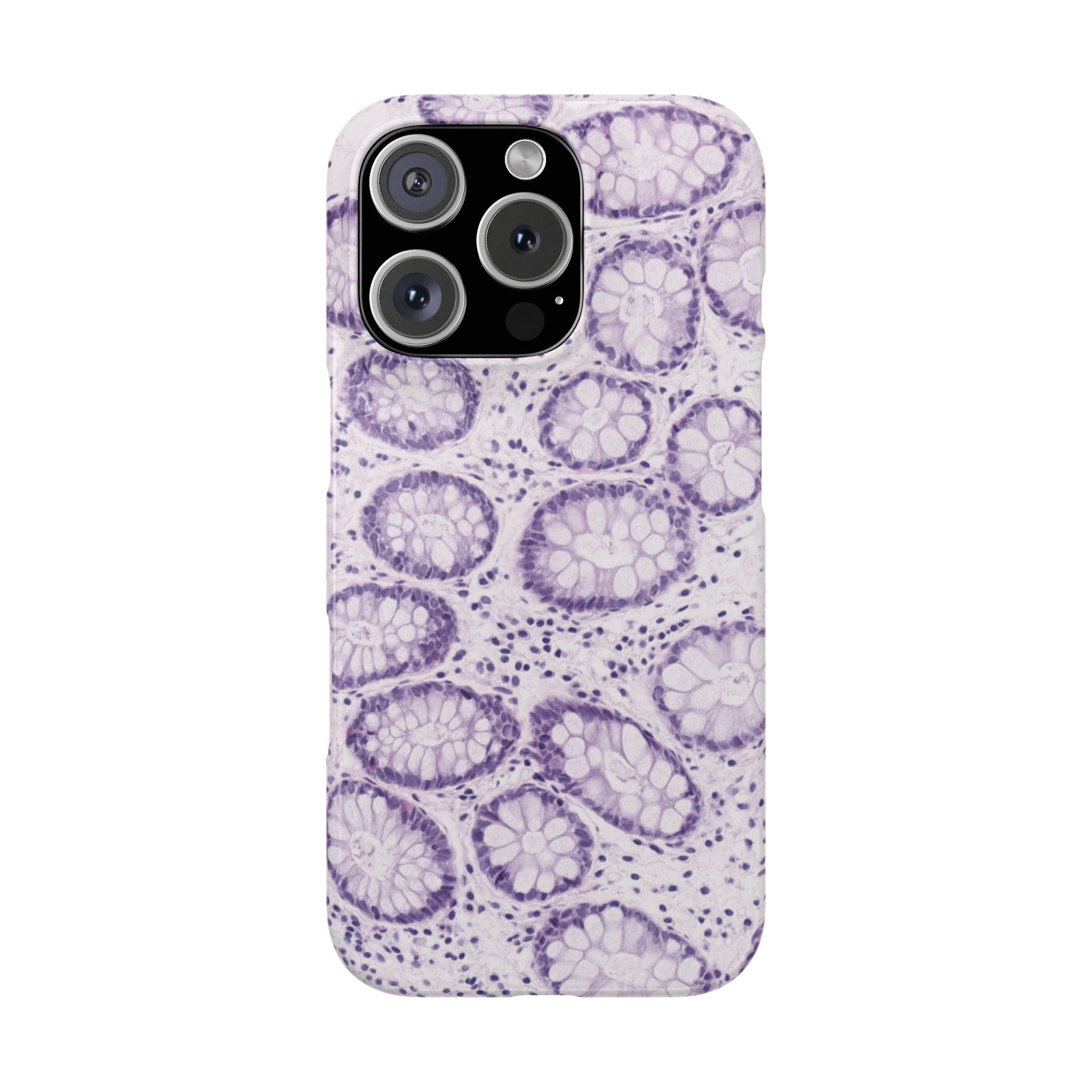 Slim Case Kolon