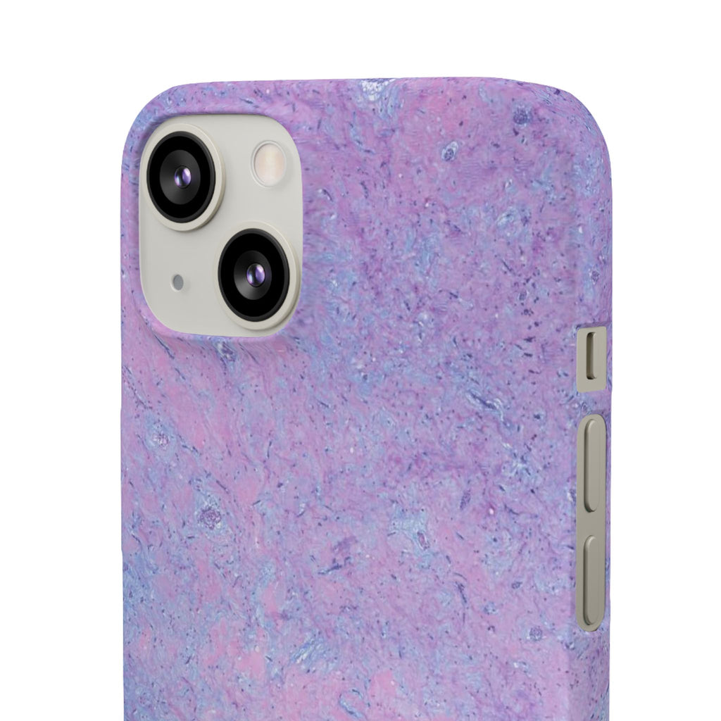 Slim Case Arterielles Myxom