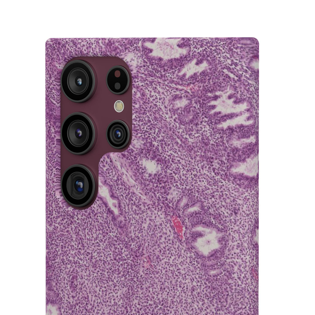 Slim Case Endometrium