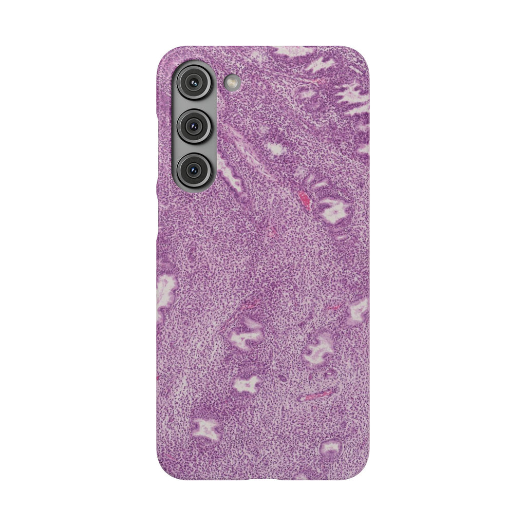 Slim Case Endometrium