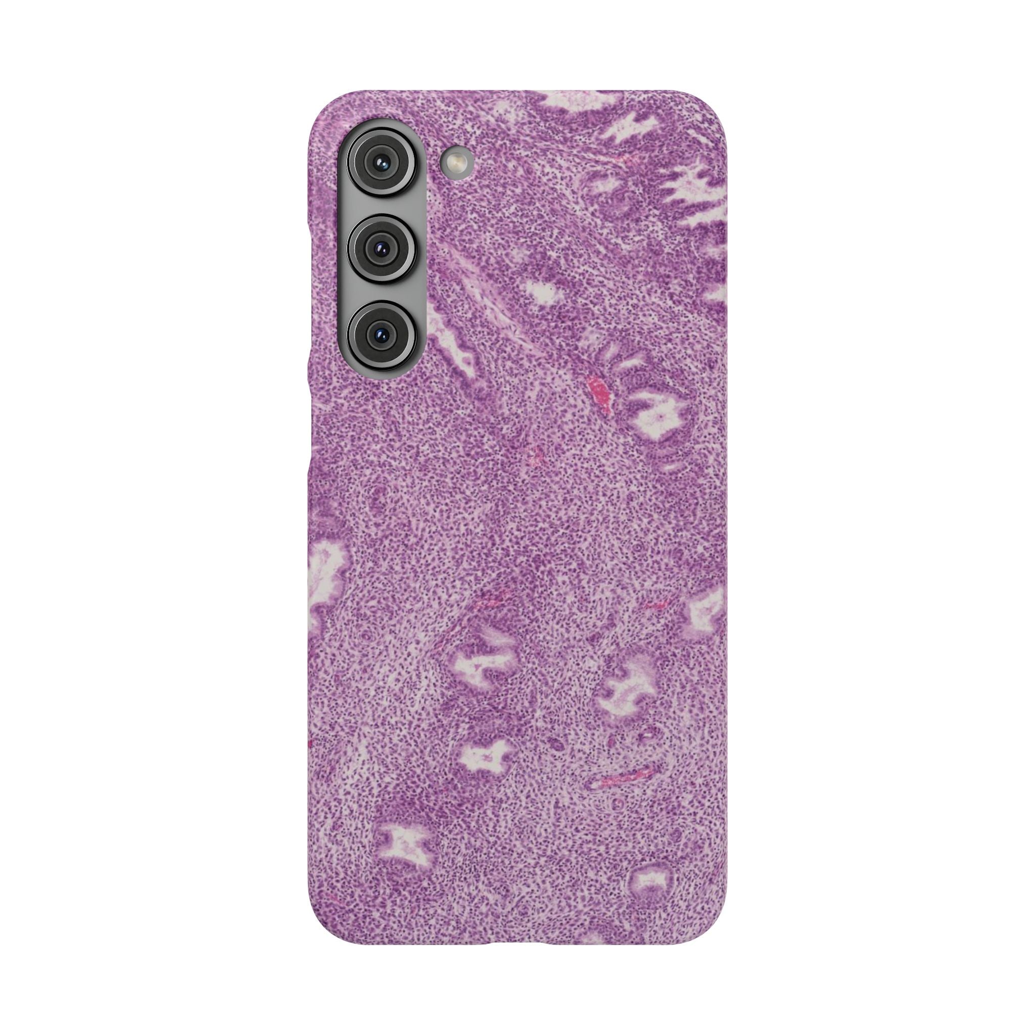 Slim Case Endometrium