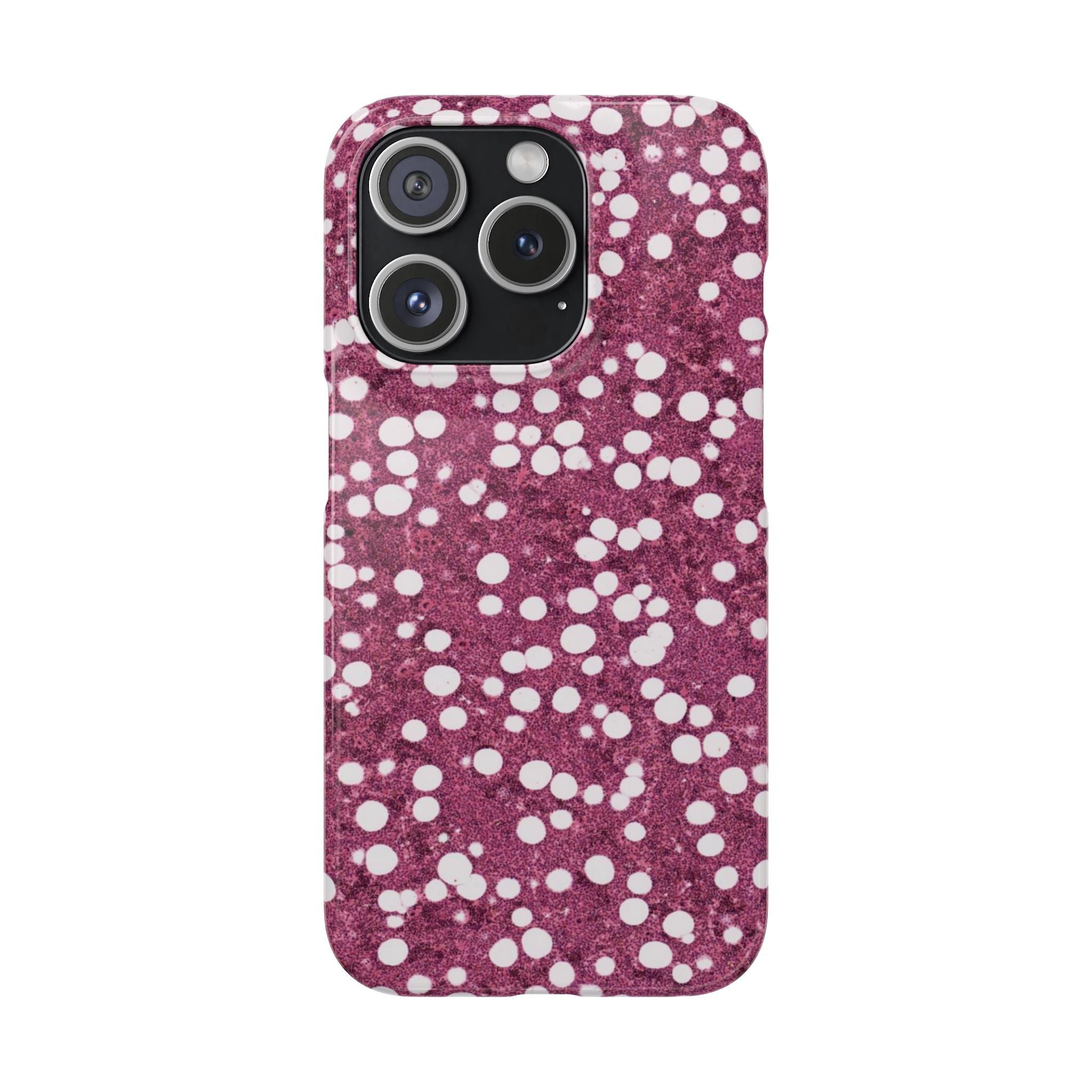 Slim Case Myelolipom