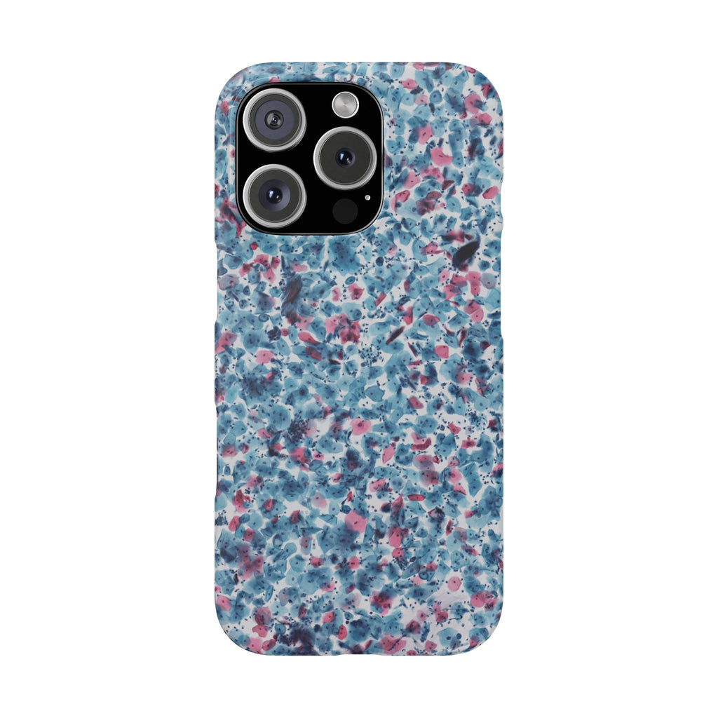 Slim Case PAP