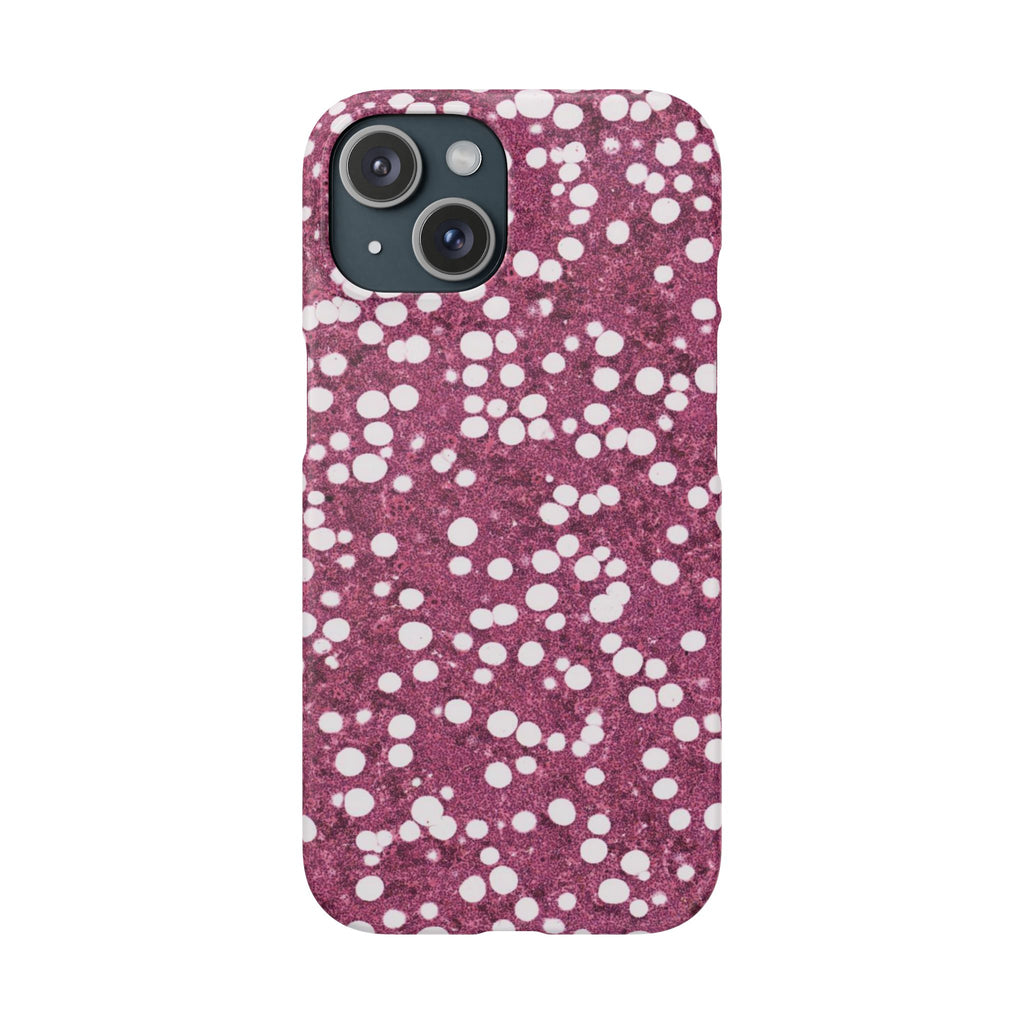 Slim Case Myelolipom