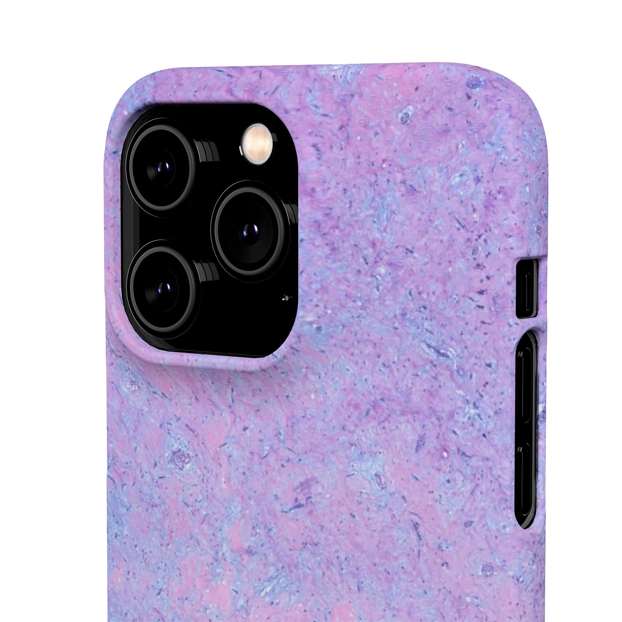 Slim Case Arterielles Myxom