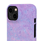 Slim Case Arterielles Myxom