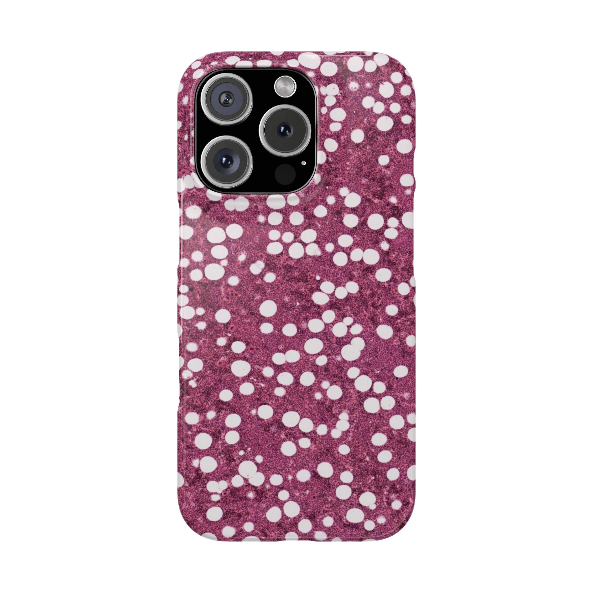 Slim Case Myelolipom
