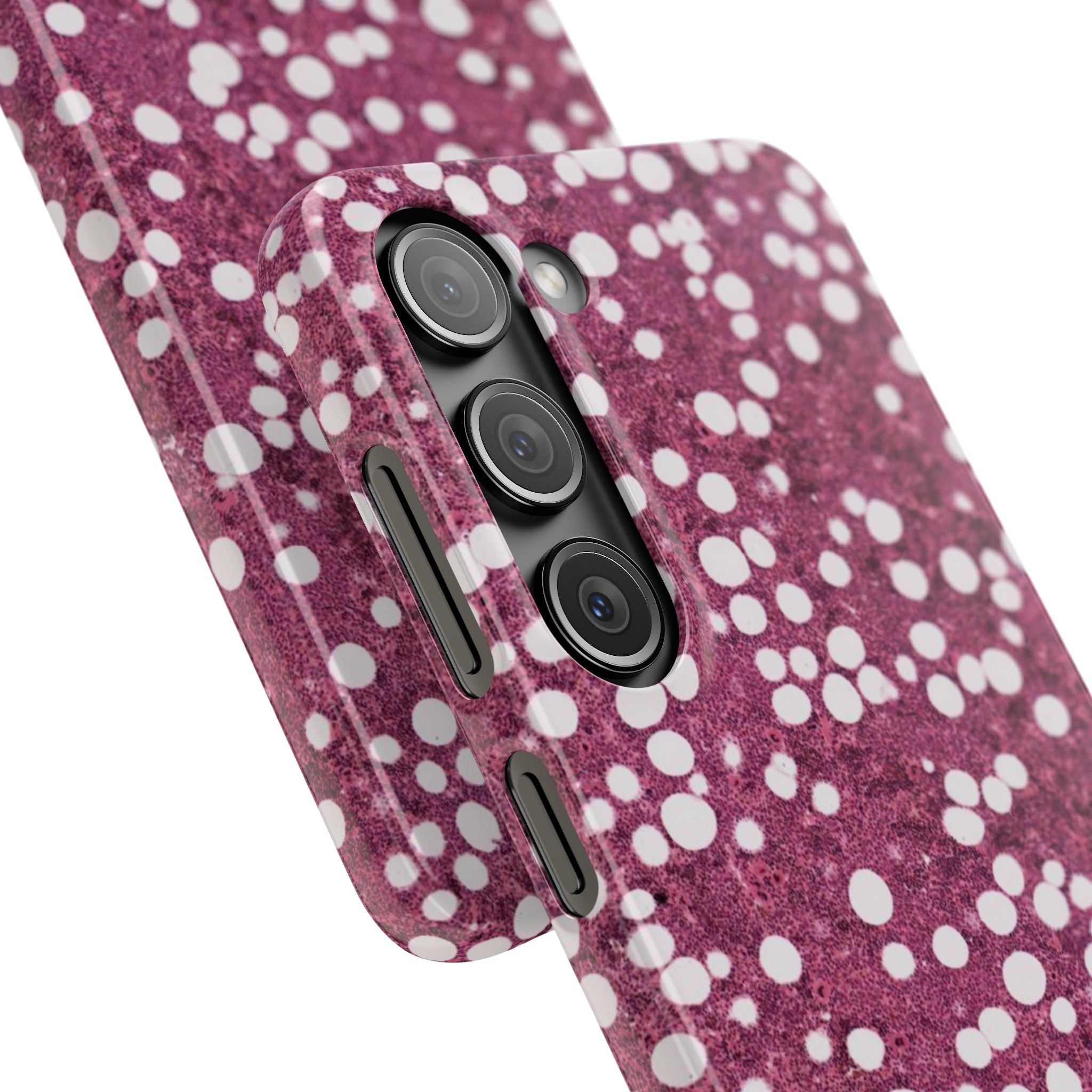 Slim Case Myelolipom
