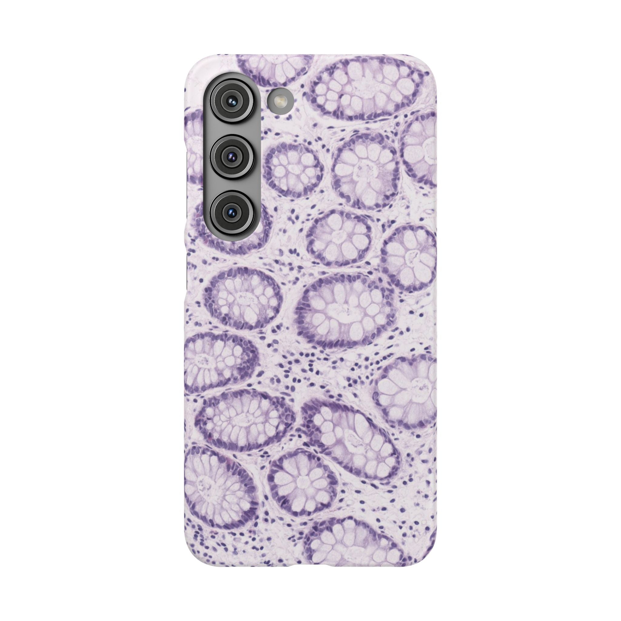 Slim Case Kolon