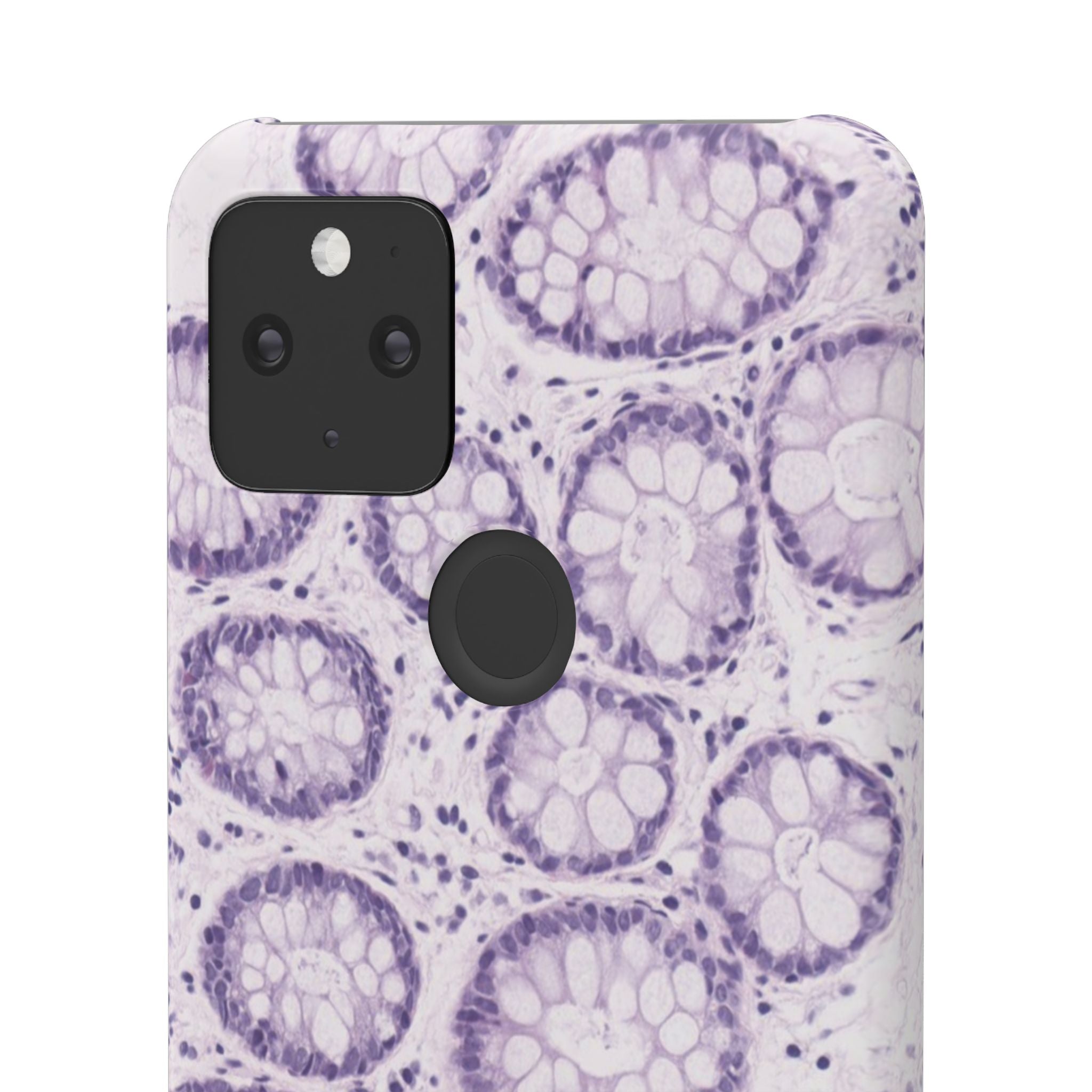 Slim Case Kolon