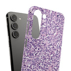 Slim Case Paraganglion