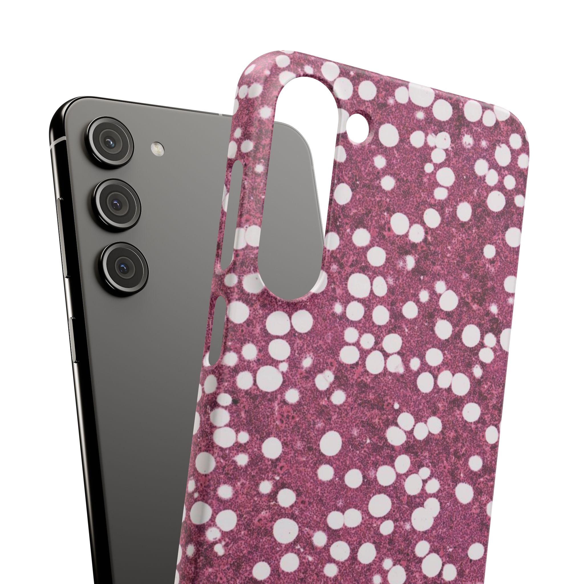 Slim Case Myelolipom