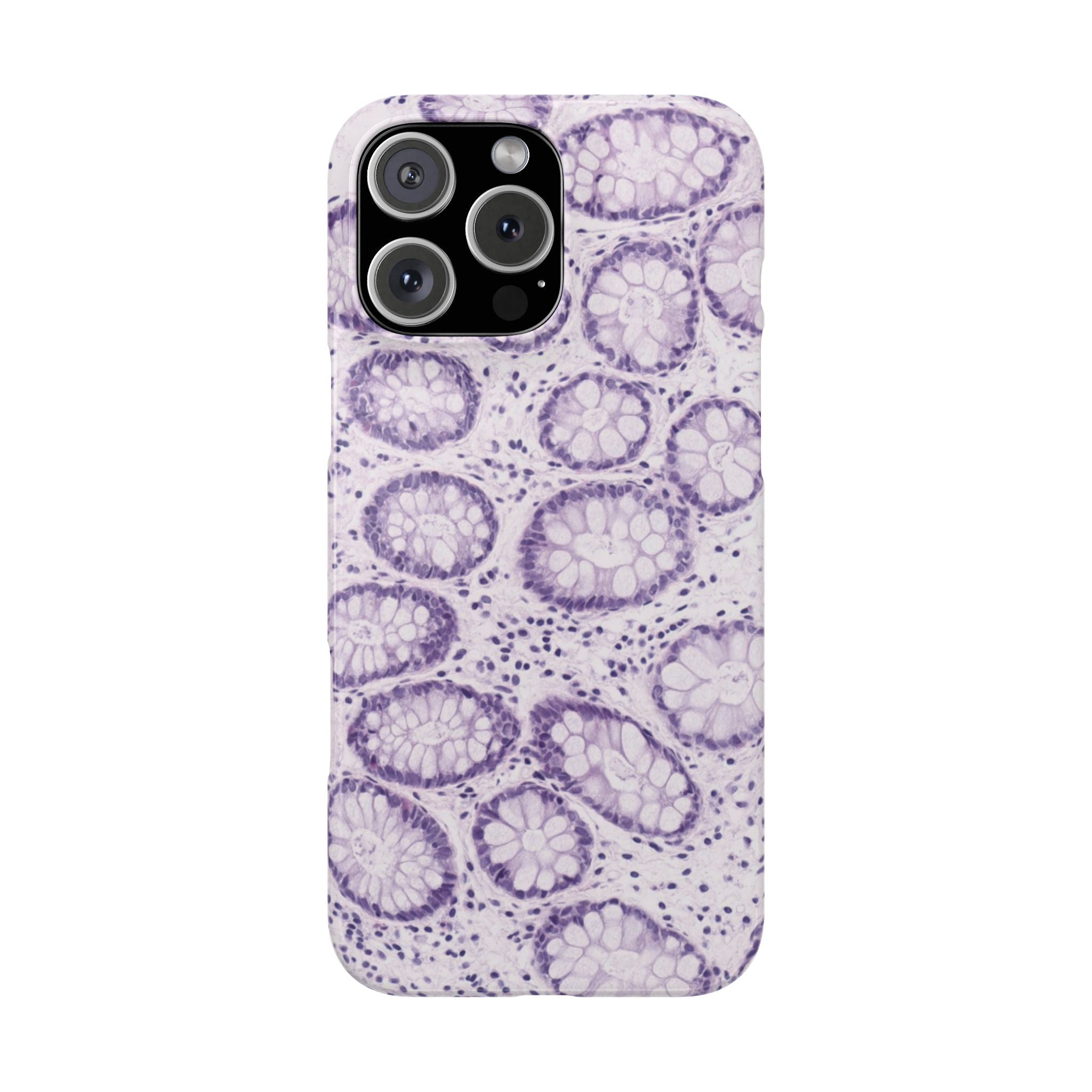 Slim Case Kolon