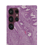 Slim Case Endometrium