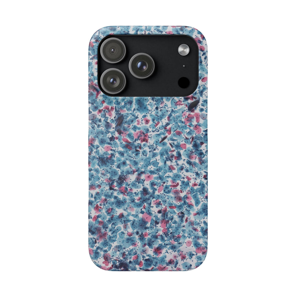 Slim Case PAP