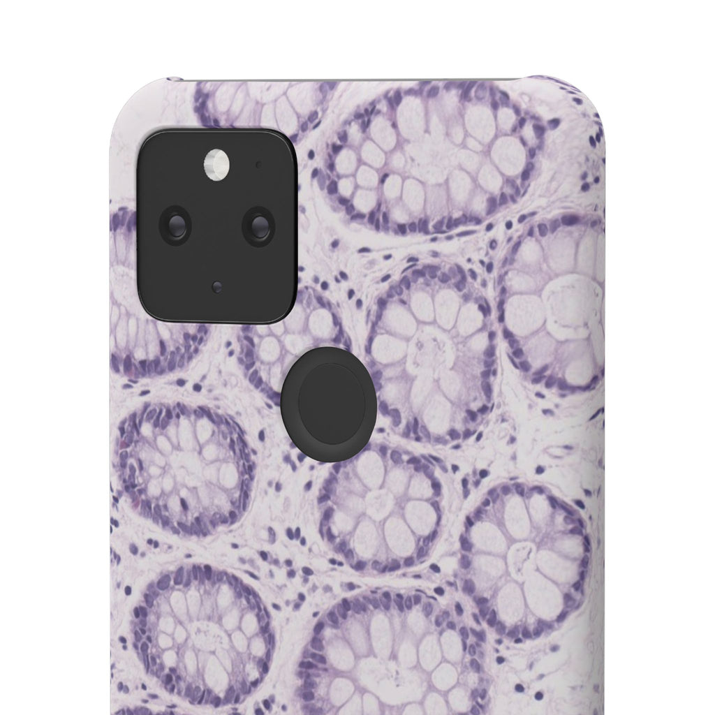 Slim Case Kolon