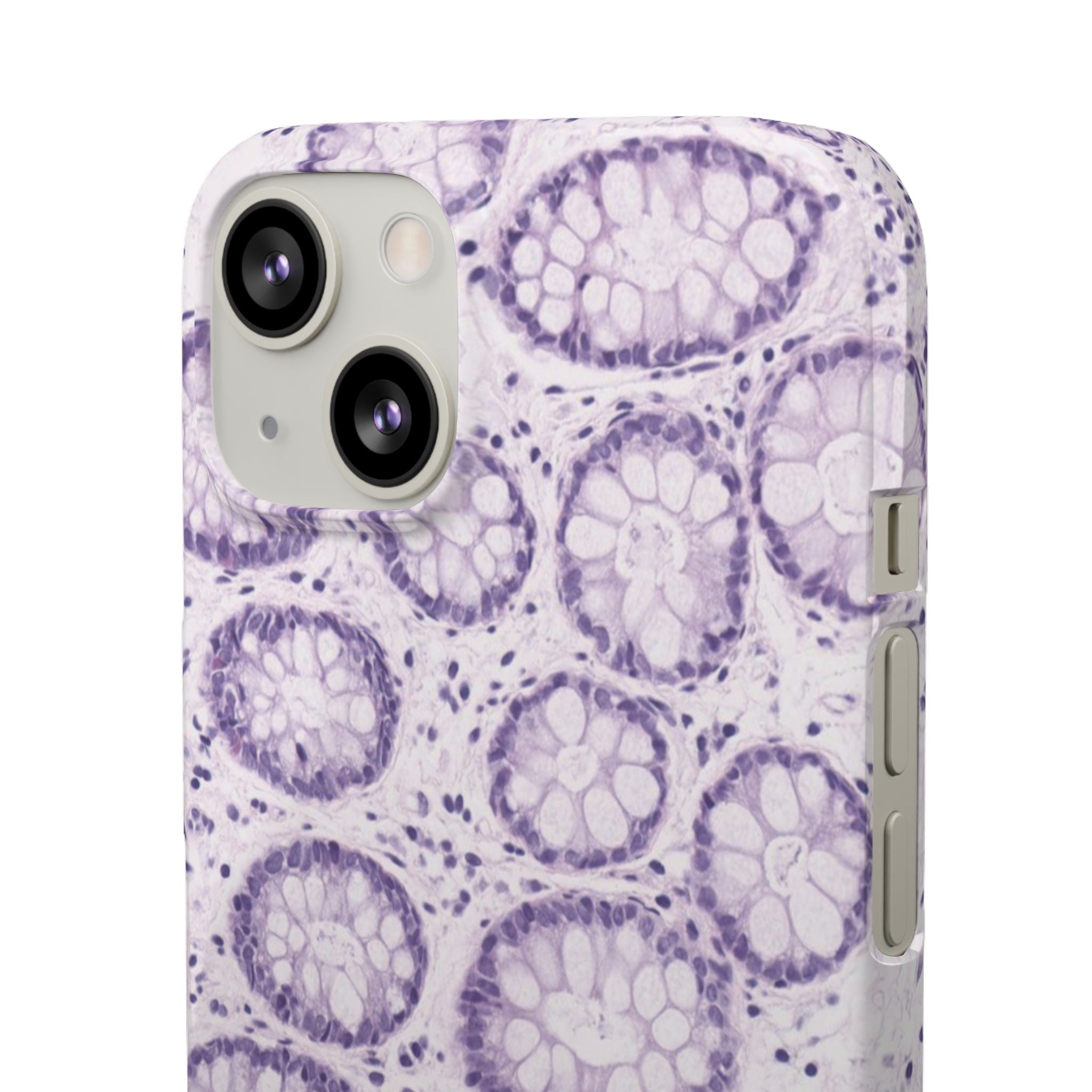 Slim Case Kolon