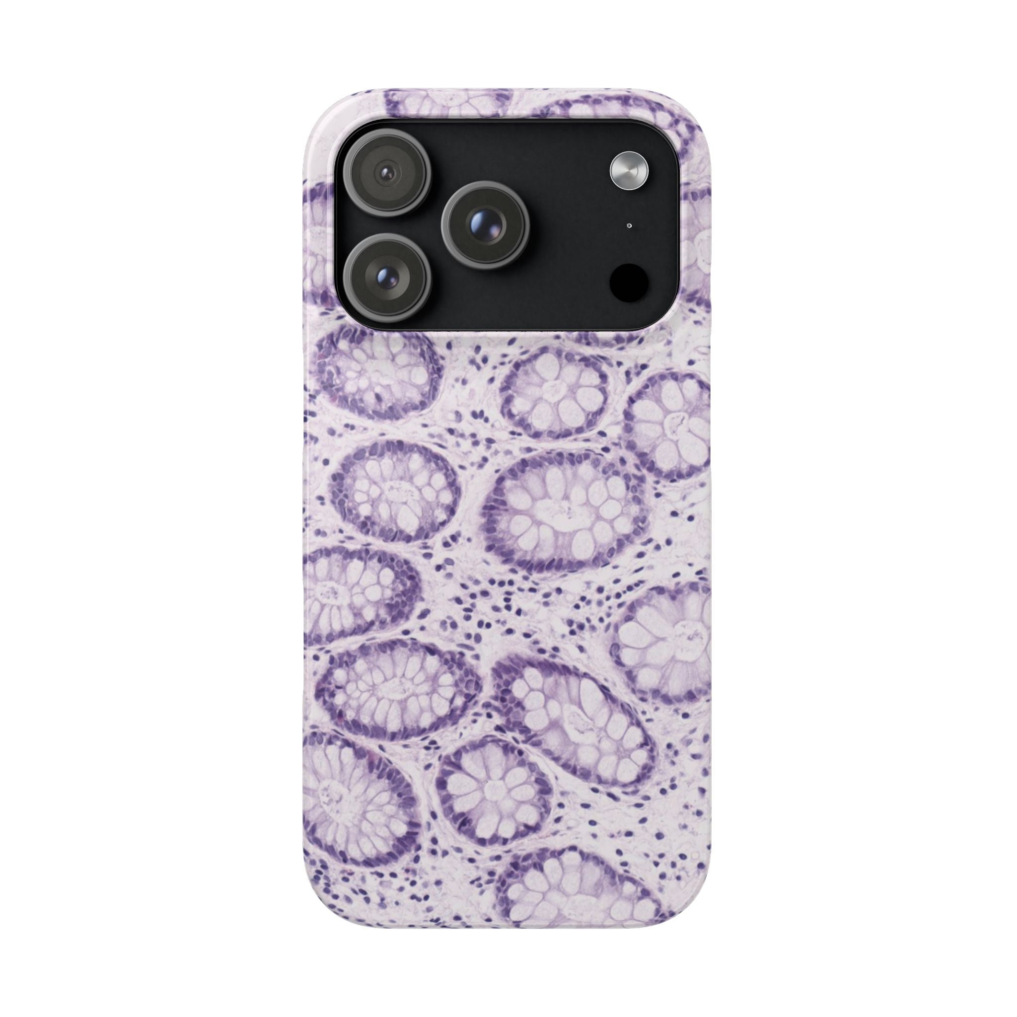 Slim Case Kolon