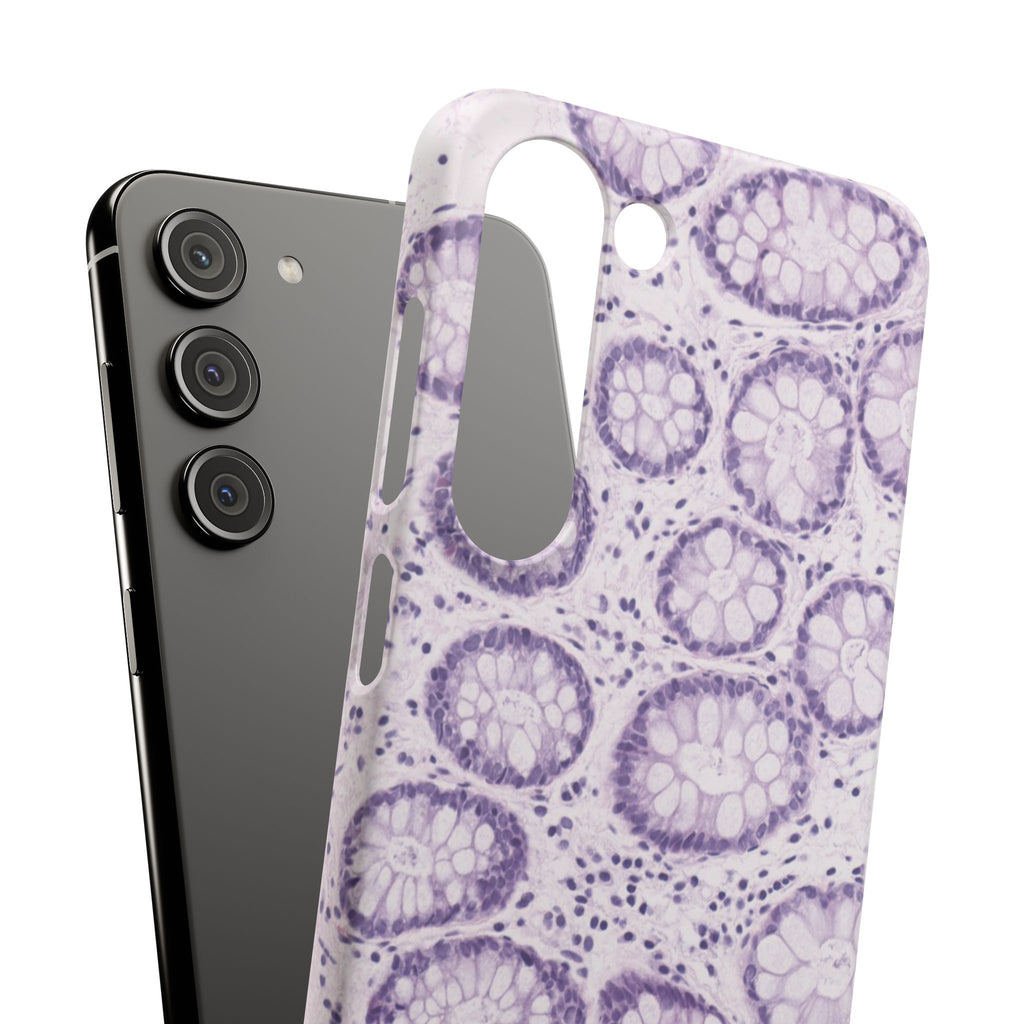 Slim Case Kolon