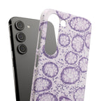 Slim Case Kolon
