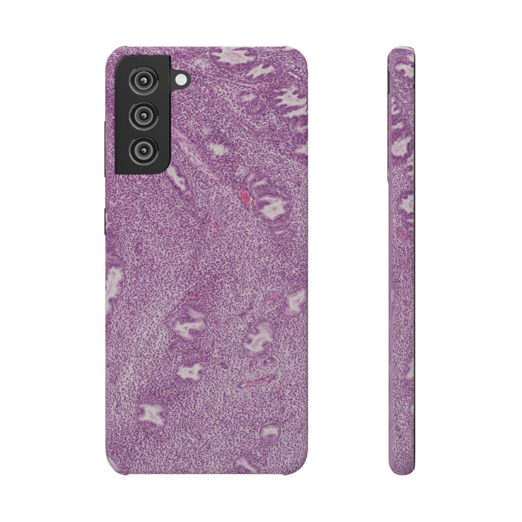 Slim Case Endometrium
