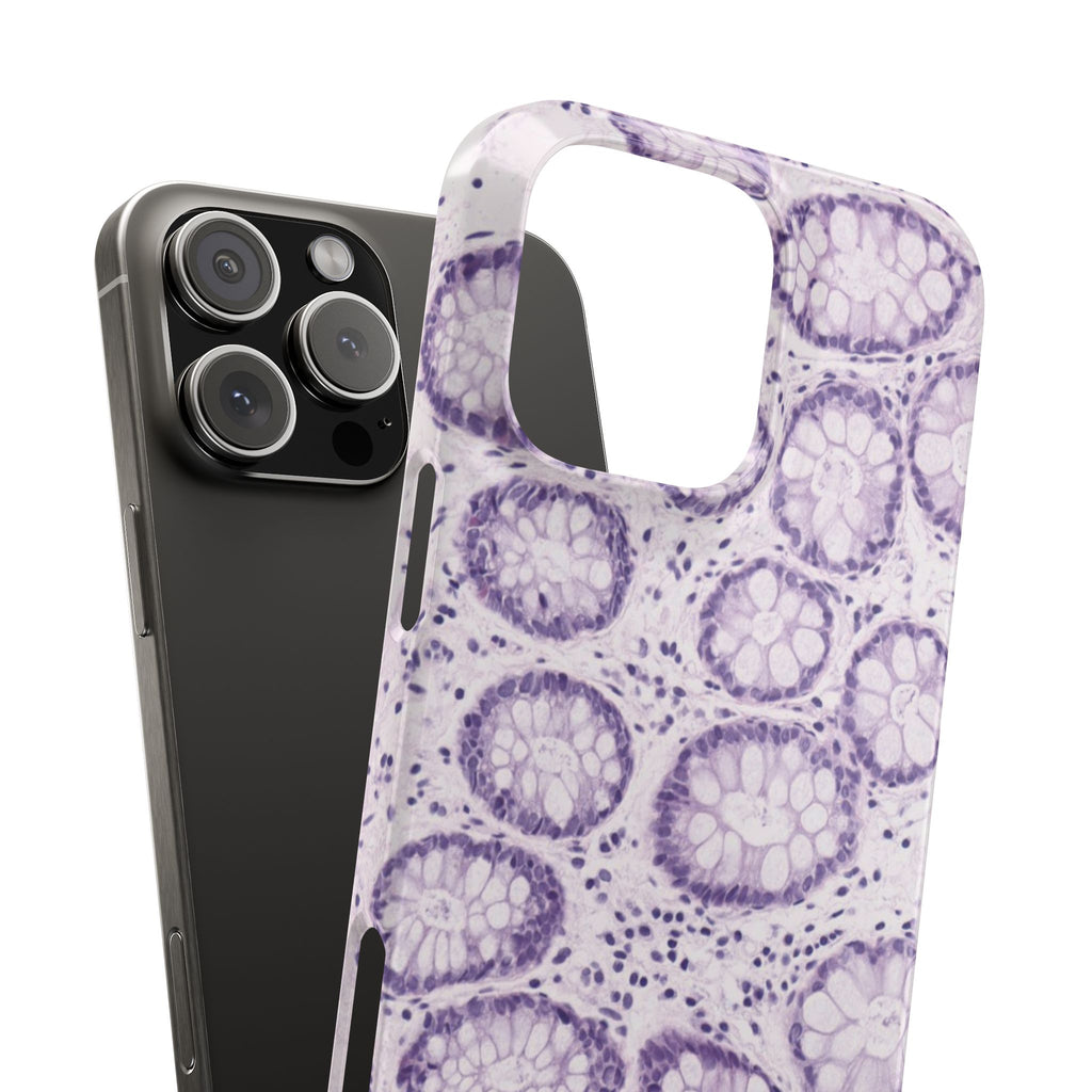 Slim Case Kolon