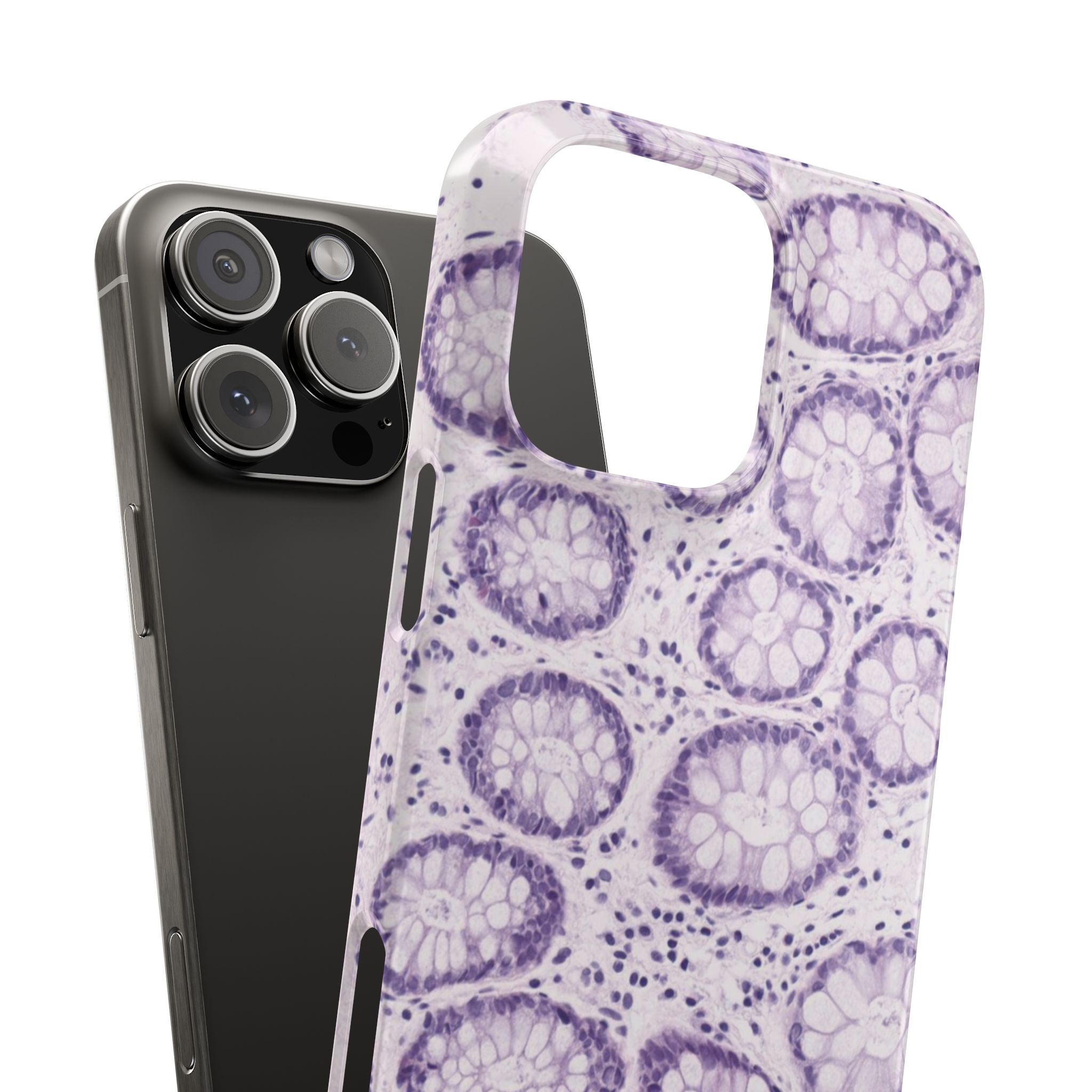 Slim Case Kolon
