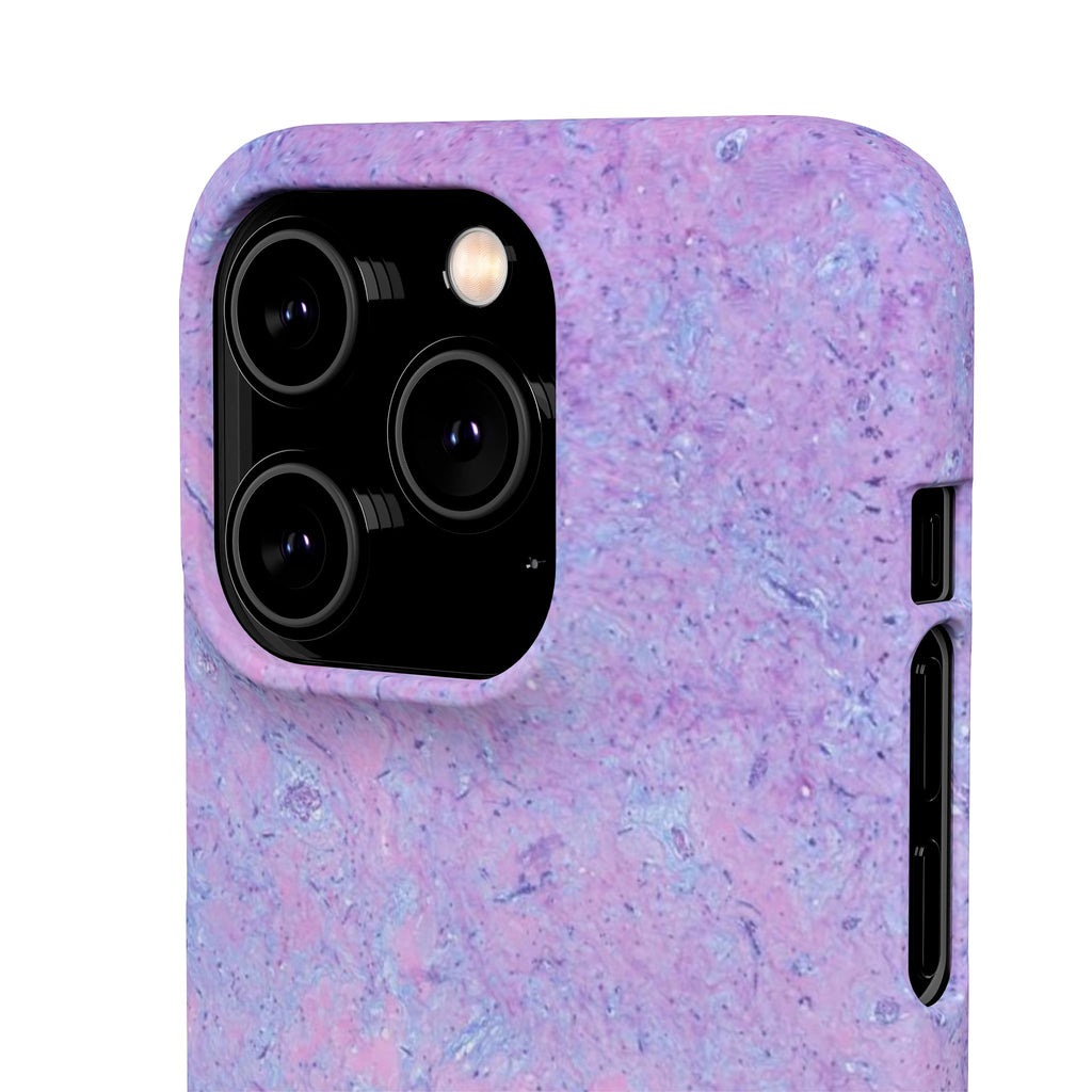 Slim Case Arterielles Myxom