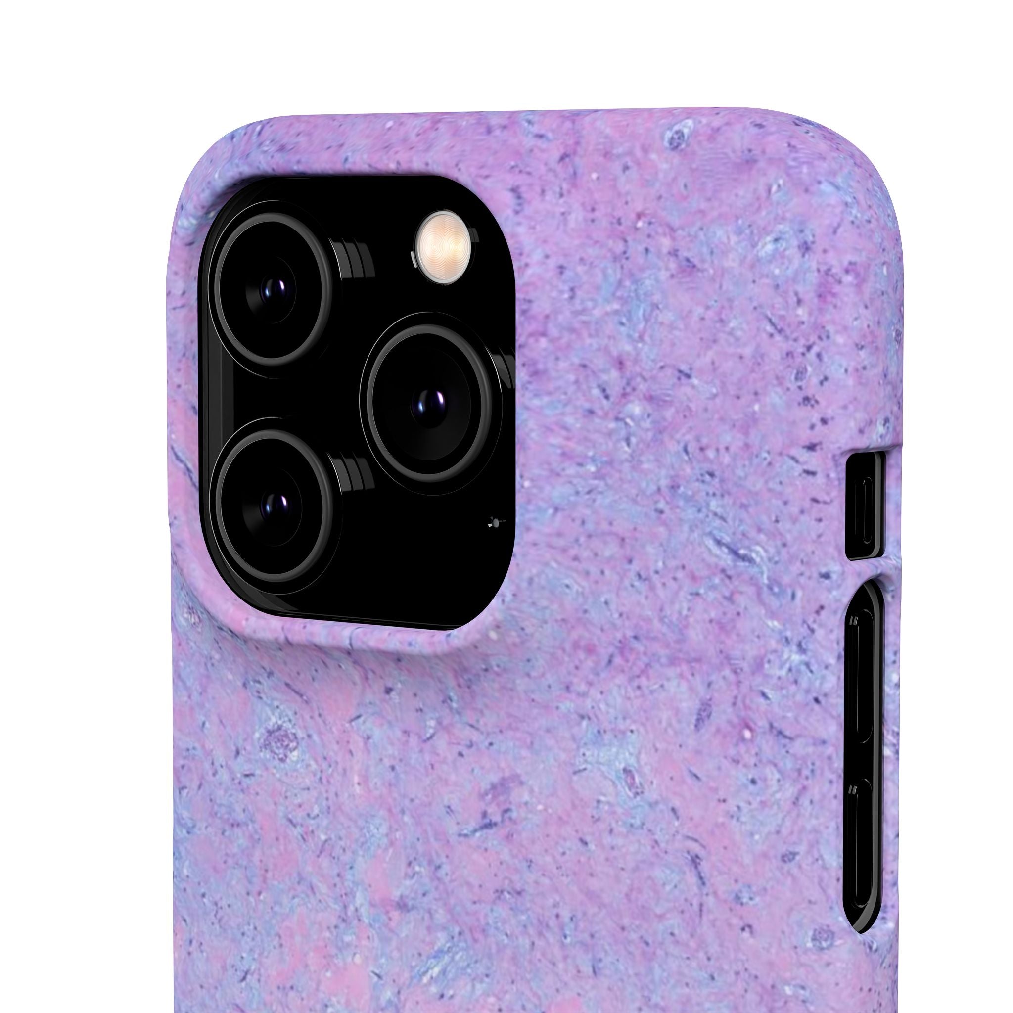 Slim Case Arterielles Myxom