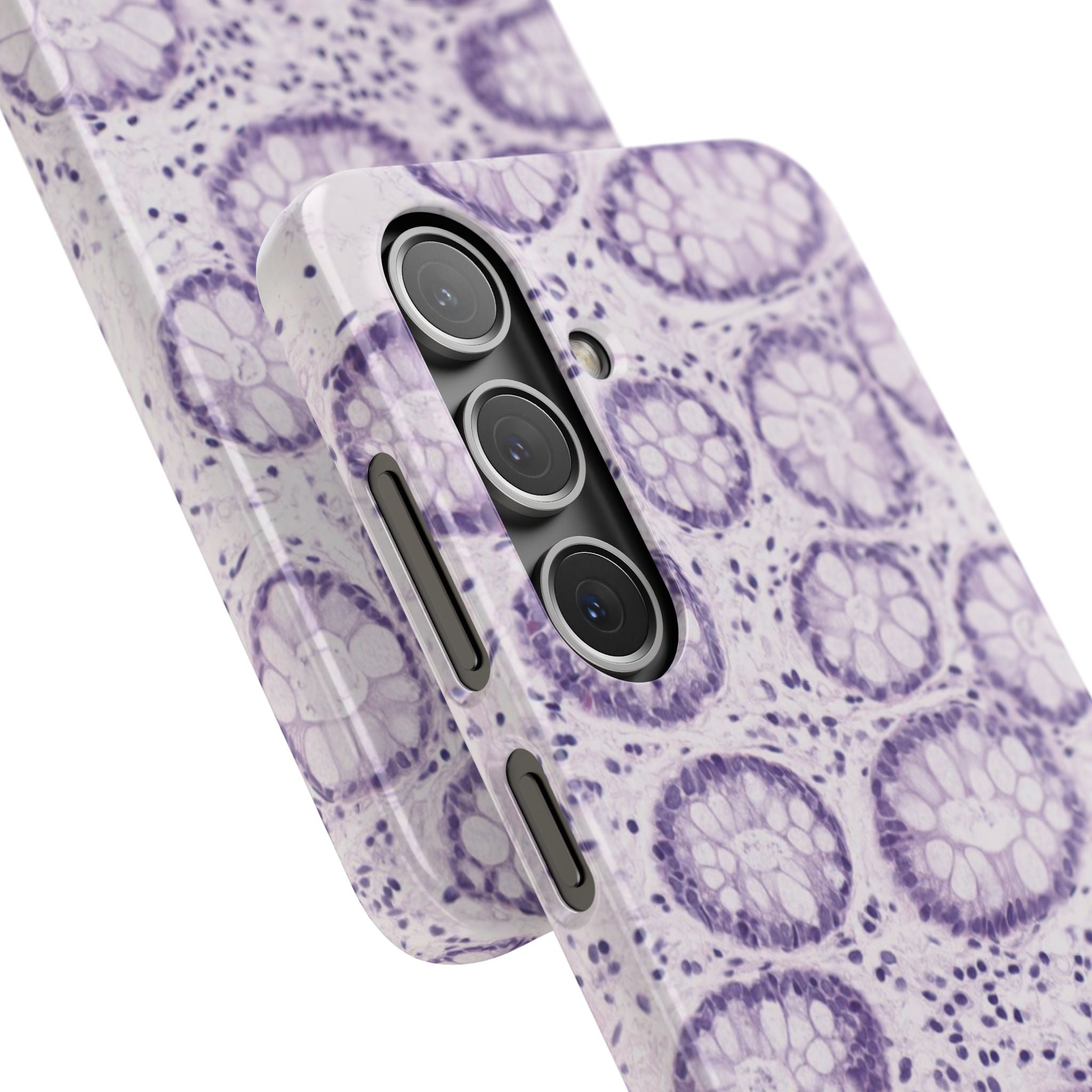 Slim Case Kolon