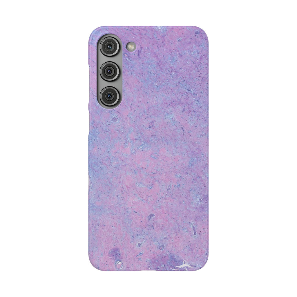 Slim Case Arterielles Myxom