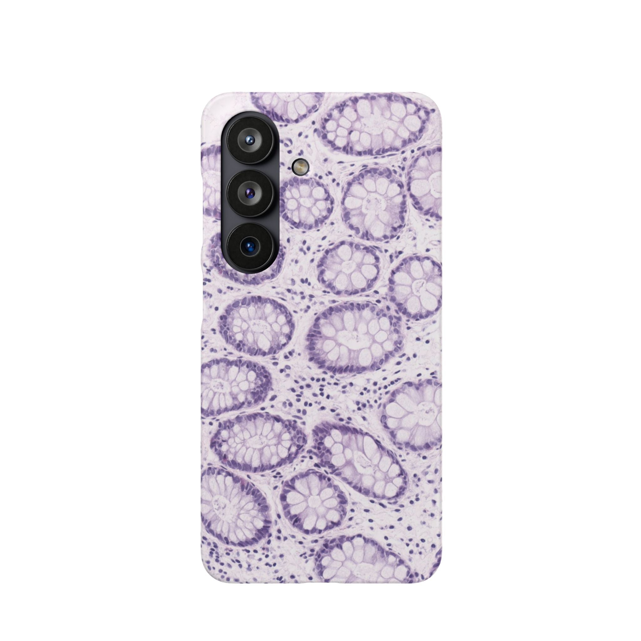 Slim Case Kolon